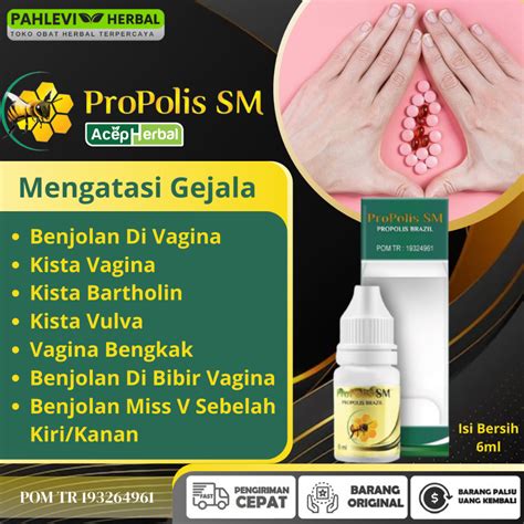 Jual Obat Menghilangkan Benjolan Di Vagina Dengan Propolis Sm Brazil