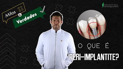 PERIODONTITE E PERI IMPLANTITE YouTube