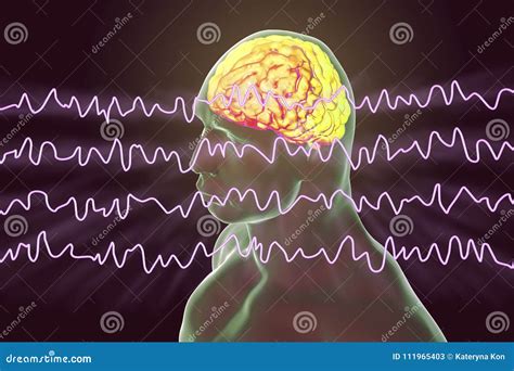 Eeg Cartoons Illustrations And Vector Stock Images 646 Pictures To