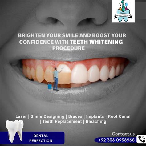 Dental Perfection Dental Surgeonandclinic Islamabad