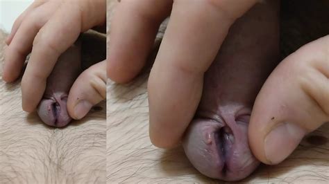 Ultratight Banding With Elastrator Bands Austrian Gay Amateur Porn XHamster