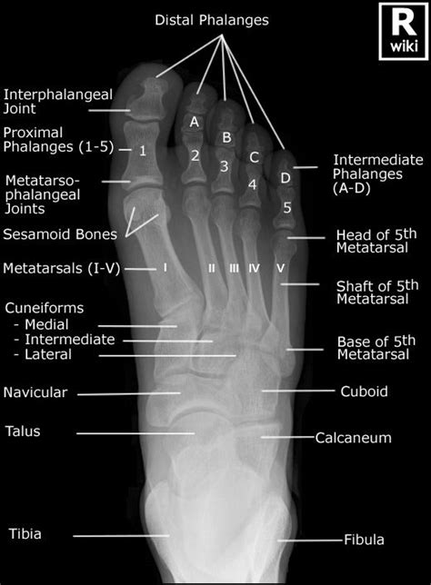 Foot Radiographic Anatomy Radiology Student Medical Anatomy Radiology