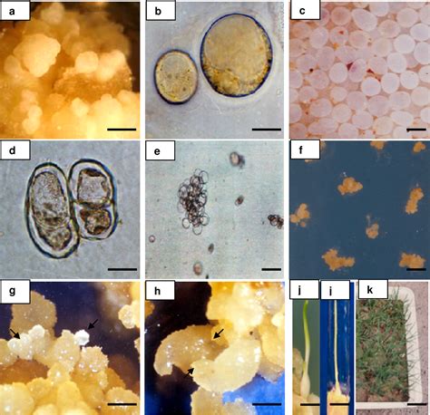 Figure 1 From Somatic Embryogenesis And Plantlet Regeneration From