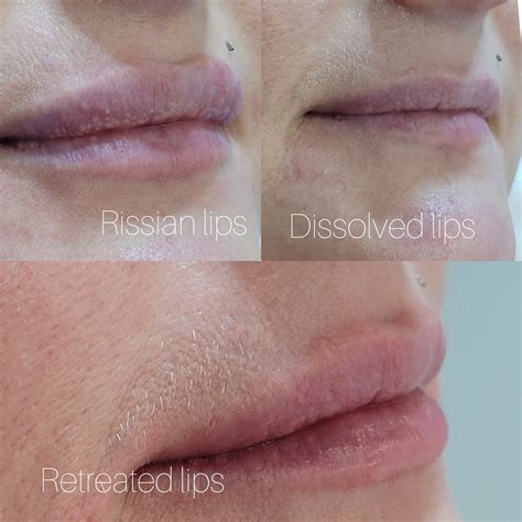 My personal experience of Russian Lips - Nottingham Salons - Angels