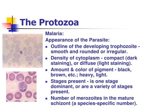 Ppt The Protozoa Powerpoint Presentation Free Download Id1471902