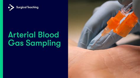 Arterial Blood Gas Sampling