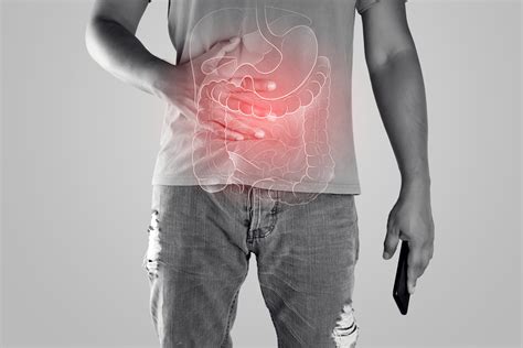 Is There An IBS Cure? Managing Symptoms Effectively