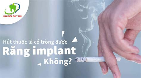 Hút thuốc lá có trồng răng implant được không? Nha khoa Thùy Anh - nhakhoathuyanh