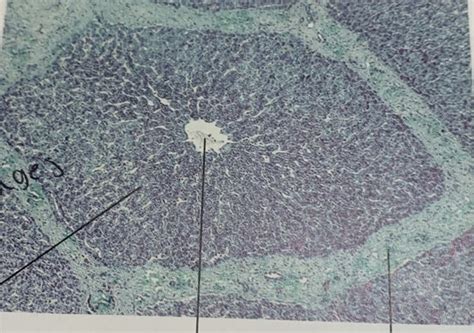 lobule diagram quizlet