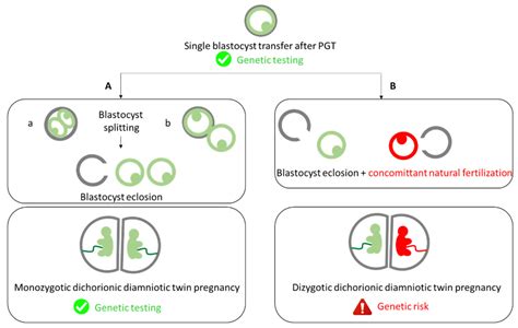 Molecular Characterization of a Rare Case of Monozygotic Dichorionic