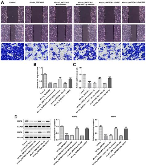 Knockdown Of Circ 0067934 Inhibits Gastric Cancer Cell Proliferation