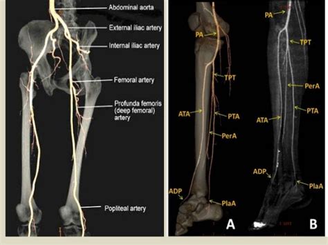 Vascular Anatomy Lower Extremity Anatomical Charts And Posters