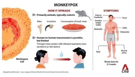 New Numerical Dynamics Of The Fractional Monkeypox Virus Model