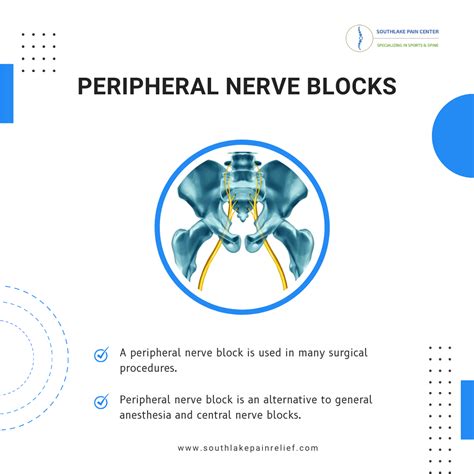Peripheral Nerve Blocks: Benefits and Procedure – South Lake Pain ...