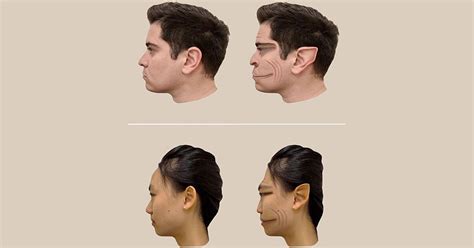 All About "Demon Face Syndrome"