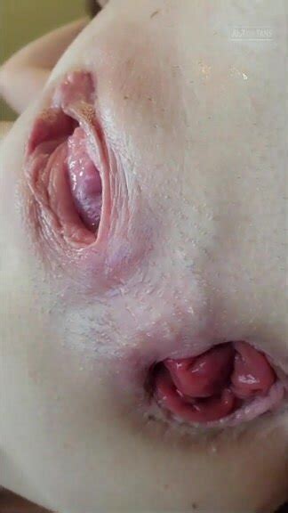 This Fucking Bitch Wants You To Fuck Her Prolapse ThisVid