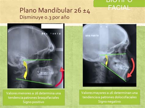 Biotipo Facial El Termino Biotiofacial Es Utilizado En Odontolog A