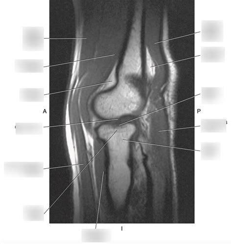 Sagittal Elbow Diagram Quizlet