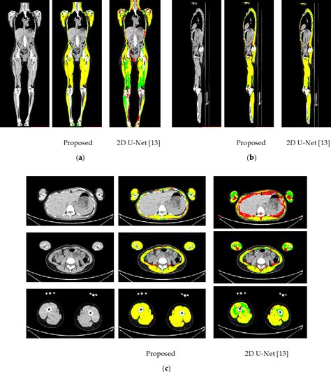 Figure 3 From Surface Muscle Segmentation Using 3d U Net Based On