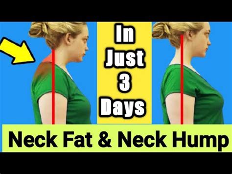 5 SIMPLE MOVES TO REDUCE NECK FAT, BACK NECK FAT | NECK FAT LOSS ...