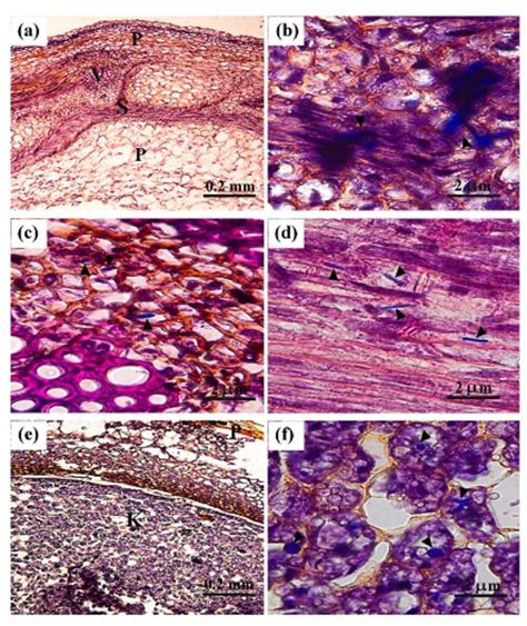 Figure 3 From Aspergillus Flavus Virulence In Pods And Seeds Of Peanut