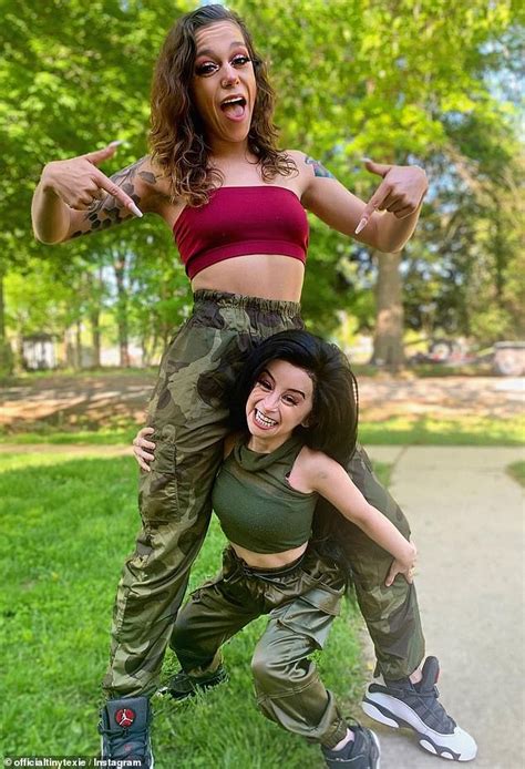 Lesbian Who Is Dating A Woman With Rare Condition That Makes It So She Doesn T Grow Claps Back