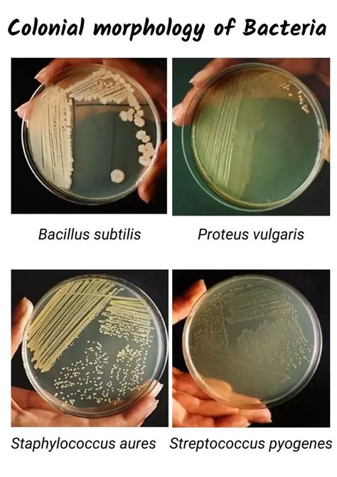 Bacterial Colony Morphology Medical Laboratories