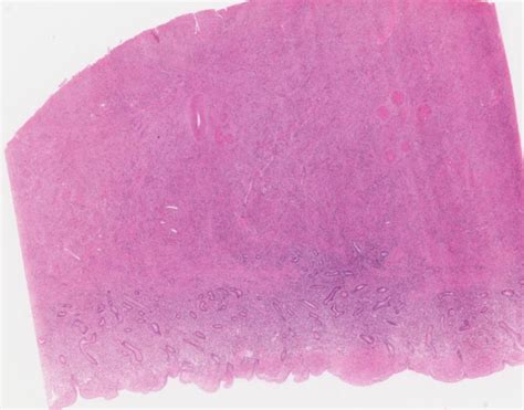 Proliferative Phase Diagram | Quizlet