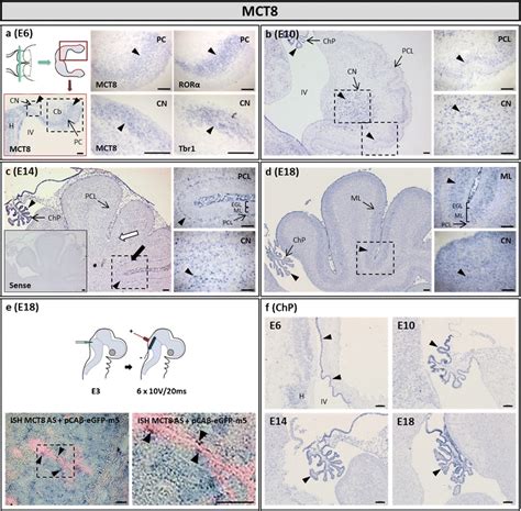 Expression Pattern Of Mct8 Mrna In The Cerebellum And Fourth Ventricle