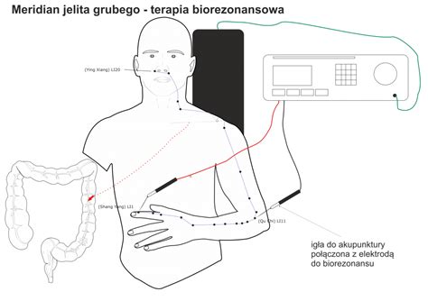 Biorezonansowe igłowanie Alergikus BioKlinik Alergiom mówimy STOP