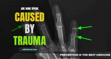 Exploring The Link Between Oral Sex And Penile Trauma What You Need To Know Medshun