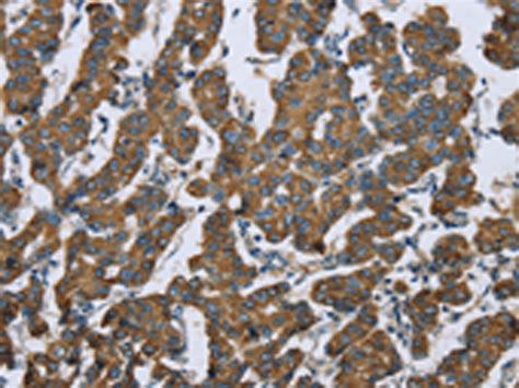 KRT5 Antibody - SAB | Signalway Antibody