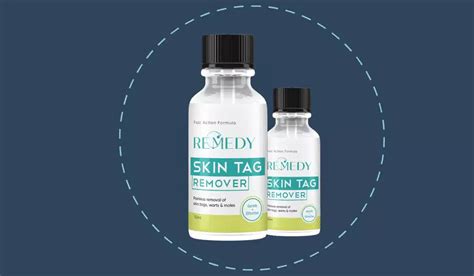 Remedy Skin Tag Remover Reviews- Ensures Removal Of Skin Tags And Moles?