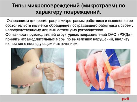 Производственный травматизм, профессиональные заболевания и их ...