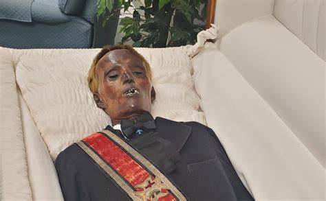 Embalmed Body After 10 Years