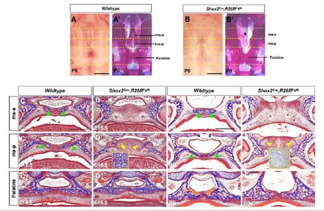 Figure 2 From Fgf8 Signaling Alters The Osteogenic Cell Fate In The