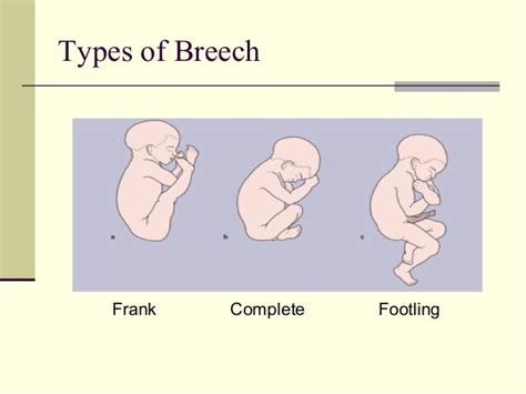 breech