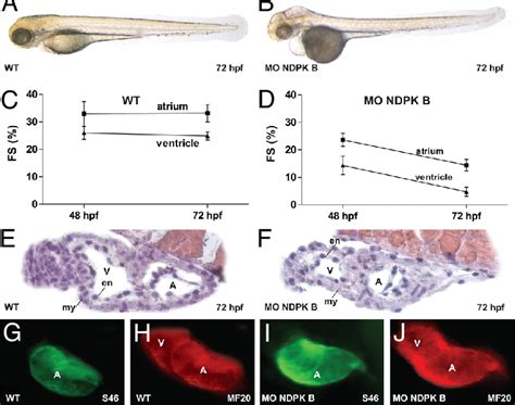 Cardiac Dysfunction In Ndpk B Depleted Zebrafish Embryos Cardiac