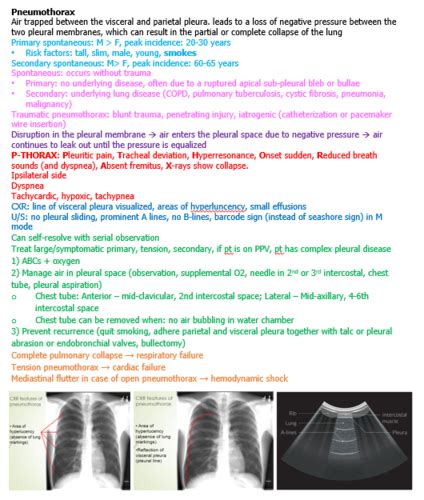 Pleural Disease Flashcards Quizlet