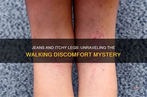Jeans And Itchy Legs: Unraveling The Walking Discomfort Mystery | ShunVogue