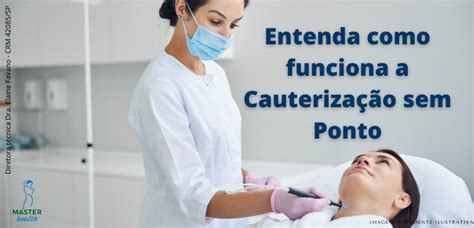O Que Significa Cauterização