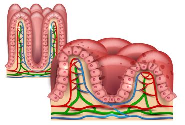 TTG-IgA Shows Potential as Noninvasive Predictor of Celiac Disease in ...