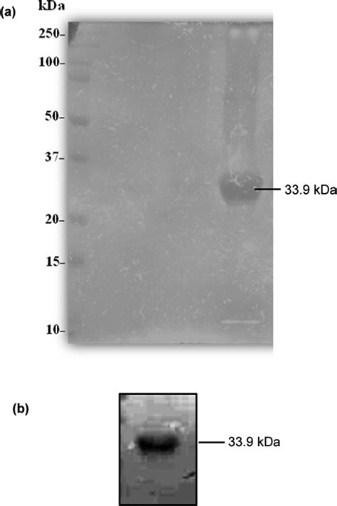 Specific Detection Of Uropathogenic Escherichia Coli Via Fourier Transform Infrared Spectroscopy