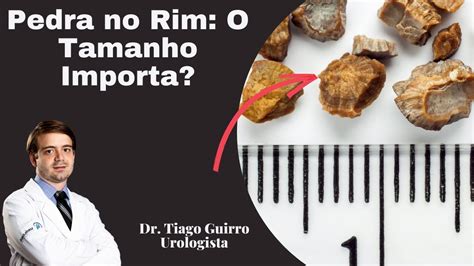 Pedra No Rim O Tamanho Importa YouTube