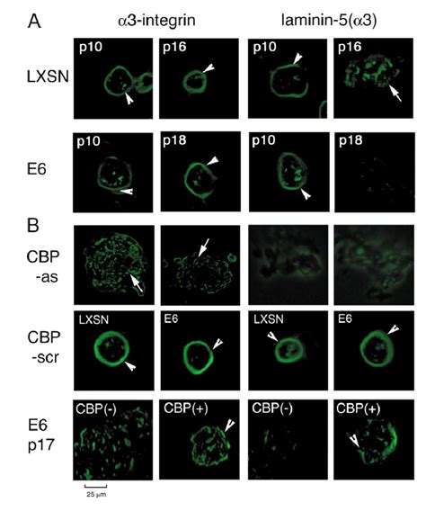 Expression And Distribution Of 3 Integrin And Laminin 5 3 Chain In