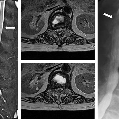 Nexus Criteria For Cervical Spine Imaging 4 Download Scientific Diagram