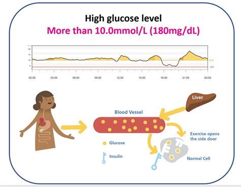 What Is Diabetes The Glucose Never Lies