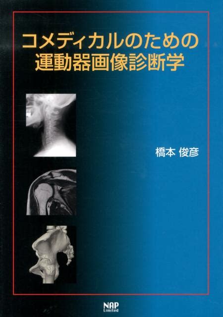 楽天ブックス コメディカルのための運動器画像診断学 橋本俊彦 9784905168232 本