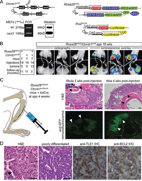 β Catenin Stabilization Enhances Ss18 Ssx2 Driven Synovial