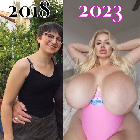 Updated Transformation After Her Second Bbl Nudes Bimbofication Nude Pics Org